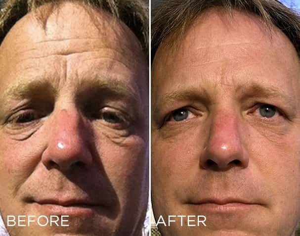 Modere Liquid Biocell LIfe – Before and After